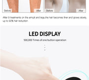 Silk Touch Pro™ IPL Hair Removal Device